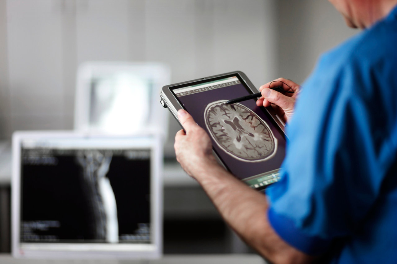 Doctor looking at a brain scan on a tablet